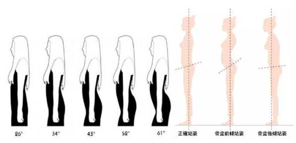 医生揭秘穿高跟鞋9大弊端