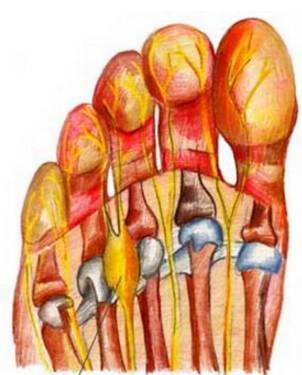 医生揭秘穿高跟鞋9大弊端