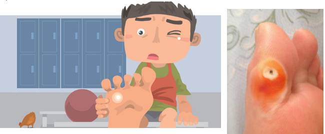 医生揭秘穿高跟鞋9大弊端