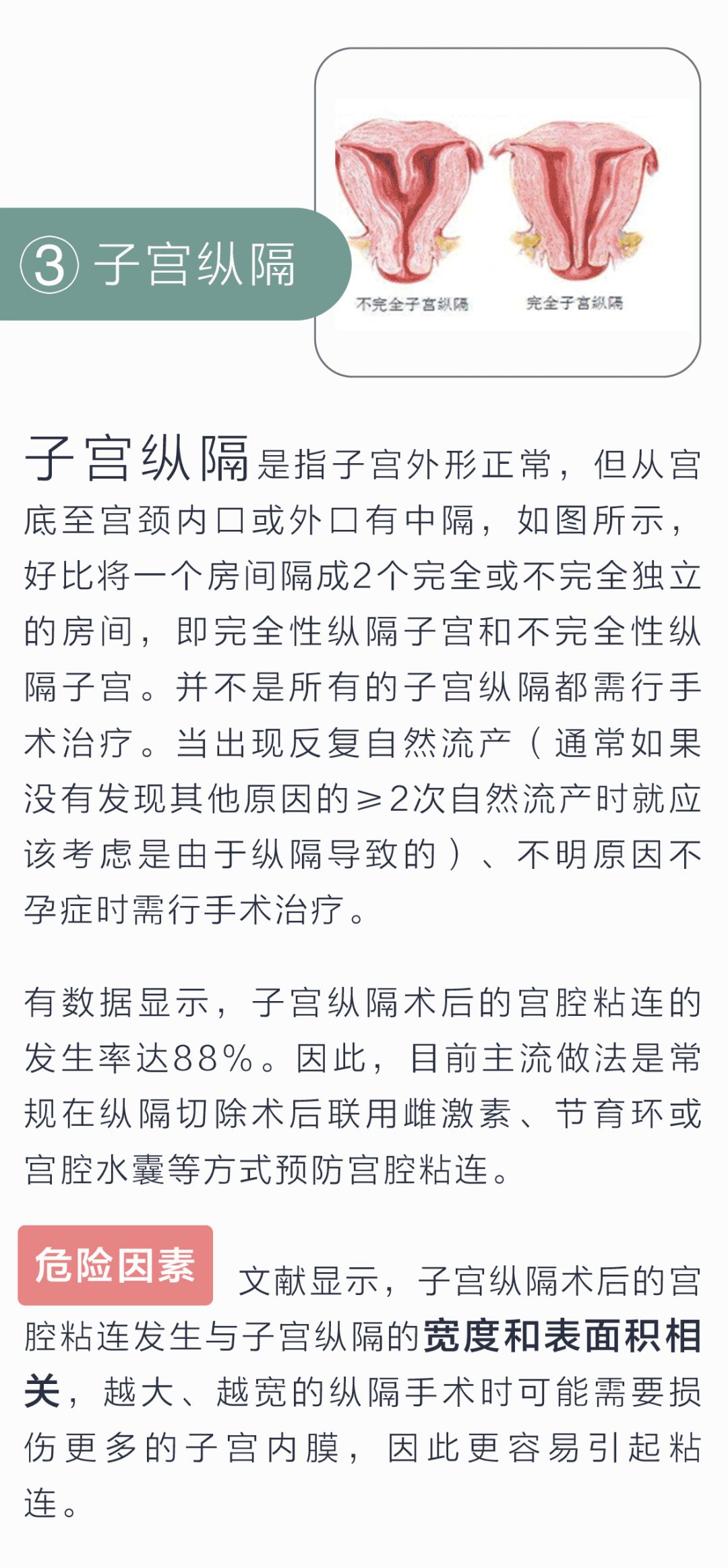 需行宫腔镜手术的5大宫腔异常及相关高危因素