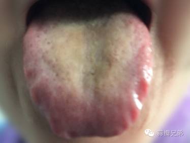 【病例解答】简易彼……(鼻炎咽炎,甲减,月经色深 血块暗红,白带正常,乳腺增生,备孕中)-怀孕期