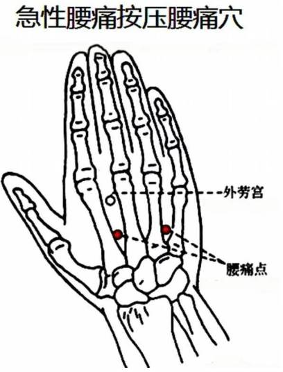 "腰痛点"位于手背食指与中指之间以及无名指与小指之间,手腕横纹与掌