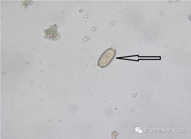 (大小约为 30μ m× 12μ m)的名称  华支睾吸虫(虫卵) 2015405请报告