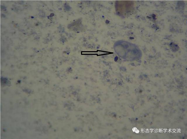 结肠内阿米巴滋养体