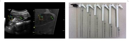 什么是超声容积探头哪些因素会决定彩超的成像质量？他的回答亮了！_https://www.jmylbn.com_新闻资讯_第13张
