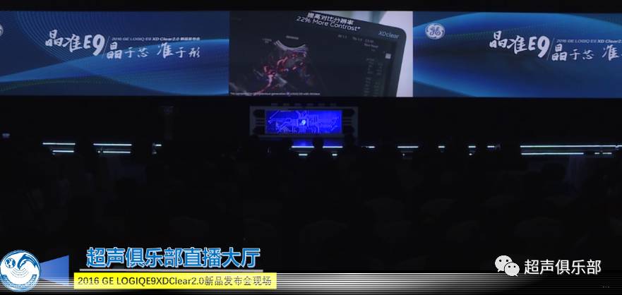 什么是超声容积探头哪些因素会决定彩超的成像质量？他的回答亮了！_https://www.jmylbn.com_新闻资讯_第16张