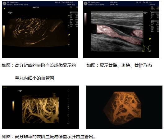 什么是超声容积探头哪些因素会决定彩超的成像质量？他的回答亮了！_https://www.jmylbn.com_新闻资讯_第10张