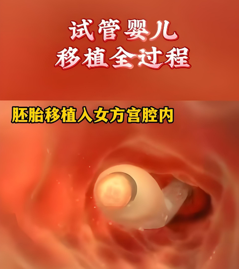 试管婴儿移植要躺两周？所有移植经验都在这里！