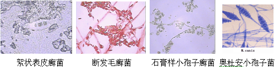 体癣初期图片_体癣图片_体癣的早期症状图片