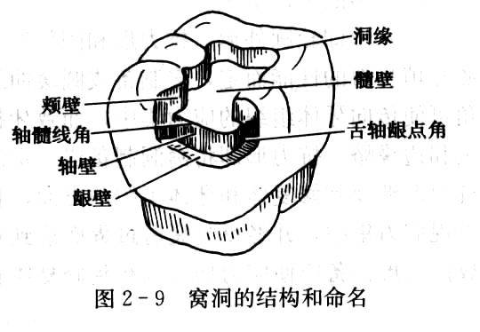 牙体牙髓常见病