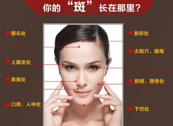 脸上长斑,体内必有瘀!