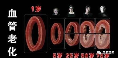 中年人，就怕血管堵！坚持喝黑茶，让血管畅通无阻！
