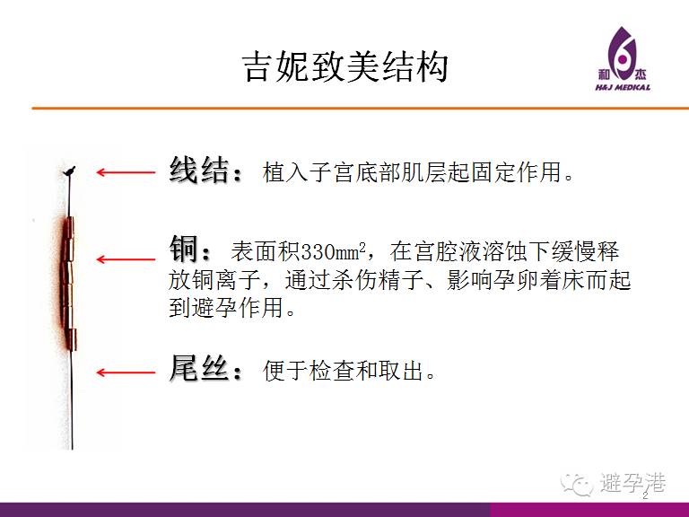 吉妮致美环怎么样吉妮致美节育器超声图像解读_https://www.jmylbn.com_新闻资讯_第1张