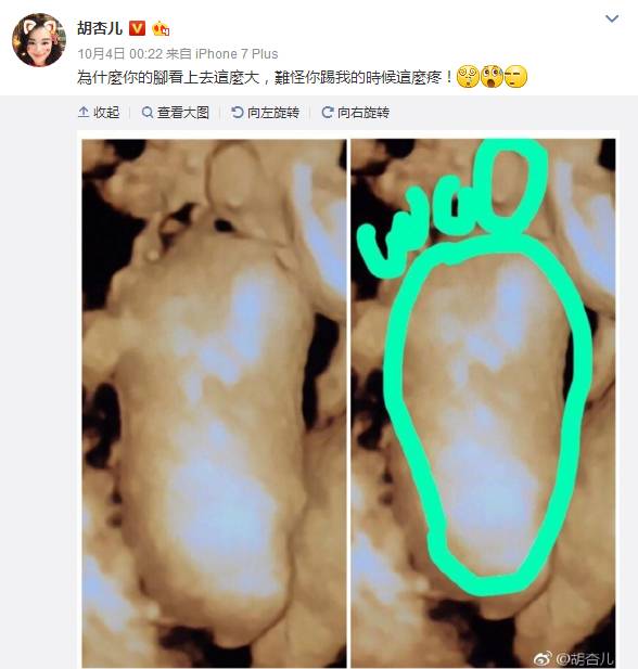 胡杏儿首晒儿子正脸!侧脸比爹帅!从“丑小鸭”蜕变成“美天鹅”,胡杏儿越来越美了!