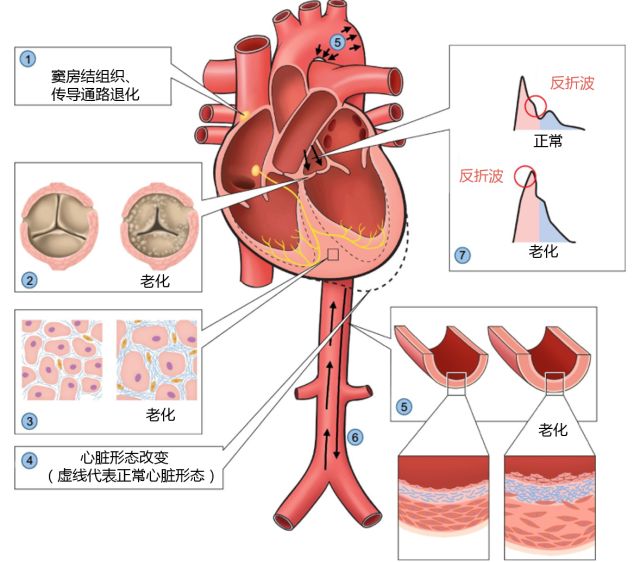 心肌细胞和心肌组织改变