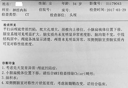 2. ct报告:脊柱侧弯,双侧胸廓不对称,骨盆结构不规则,双侧股骨扭曲.