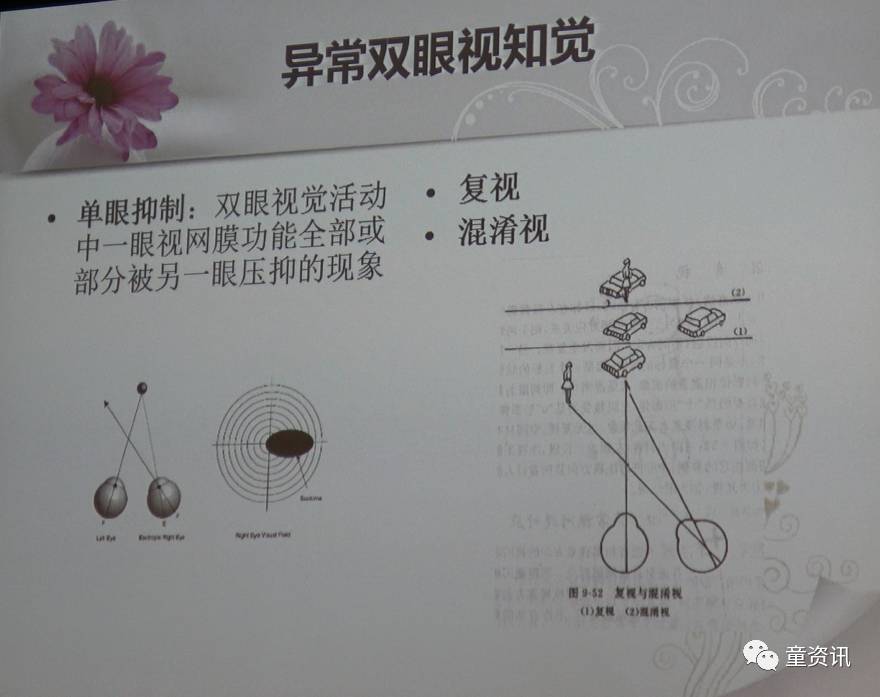 双眼视功能检查方法