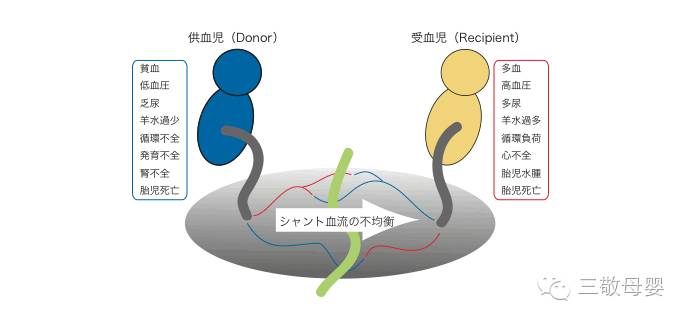 送给怀孕中的双胞胎妈妈–双胎输血综合征(TTTS)完整版-怀孕期