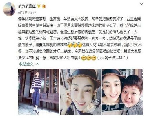 连范范都没逃过的孕期掉发究竟是怎么回事智识