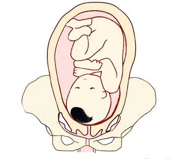 为什么要看胎位?因为它决定你能不能顺产!