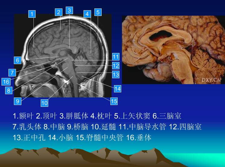 入门必备:头颅 mri 断层解剖