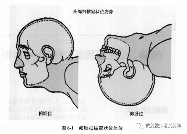 头皮下软组织病变,首选冠状位扫描,病变较小时,可在病变处用胶布固定