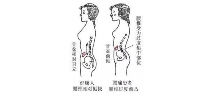 唐嫣小腹凸起疑似怀孕,原来这性感"翘臀"不是天生的!