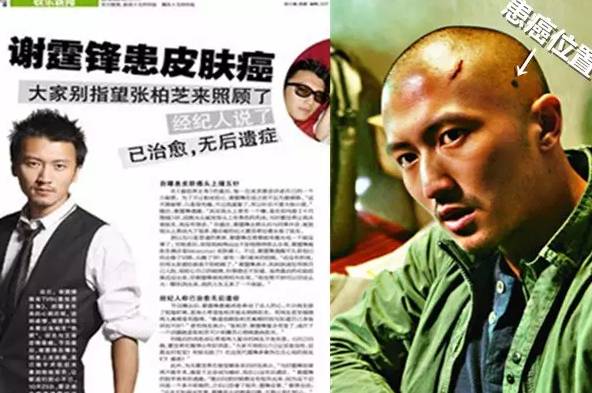 谢霆锋患皮肤癌,惊醒了多少人?你还说海·济保健没用吗?