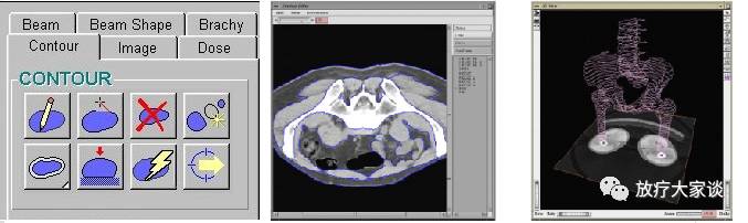 放疗计划系统有哪些放射治疗计划系统（TPS）介绍_https://www.jmylbn.com_新闻资讯_第4张