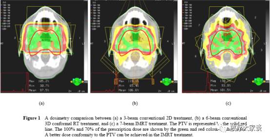 放疗计划系统有哪些放射治疗计划系统（TPS）介绍_https://www.jmylbn.com_新闻资讯_第24张