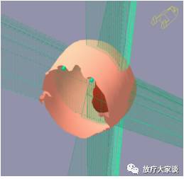 放疗计划系统有哪些放射治疗计划系统（TPS）介绍_https://www.jmylbn.com_新闻资讯_第17张