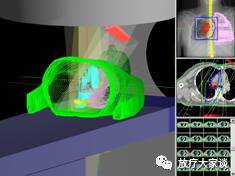 放疗计划系统有哪些放射治疗计划系统（TPS）介绍_https://www.jmylbn.com_新闻资讯_第5张