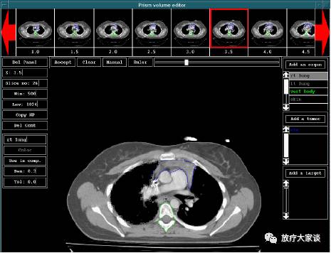 放疗计划系统有哪些放射治疗计划系统（TPS）介绍_https://www.jmylbn.com_新闻资讯_第3张