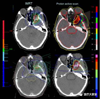 放疗计划系统有哪些放射治疗计划系统（TPS）介绍_https://www.jmylbn.com_新闻资讯_第8张