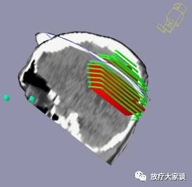 放疗计划系统有哪些放射治疗计划系统（TPS）介绍_https://www.jmylbn.com_新闻资讯_第19张