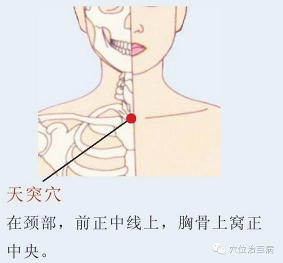 风热型:发热重,恶寒轻,鼻塞流浊涕,口渴,咽痛,苔薄黄,脉浮数.