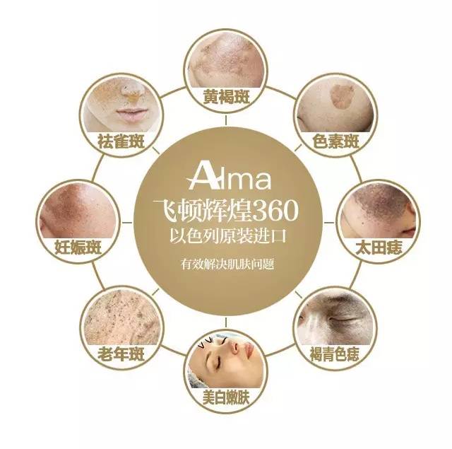 飞顿辉煌360激光