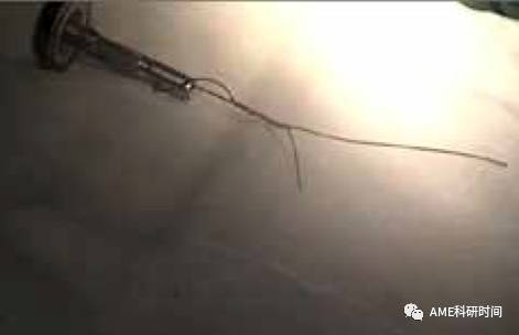 管型吻合器怎么用完全腹腔镜下全胃切除术后的消化道重建——7种食管空肠吻合方法_https://www.jmylbn.com_新闻资讯_第11张