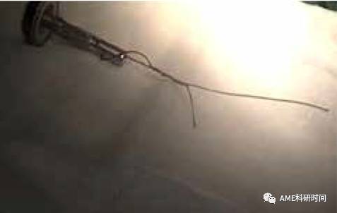 管型吻合器怎么用完全腹腔镜下全胃切除术后的消化道重建——7种食管空肠吻合方法_https://www.jmylbn.com_新闻资讯_第19张