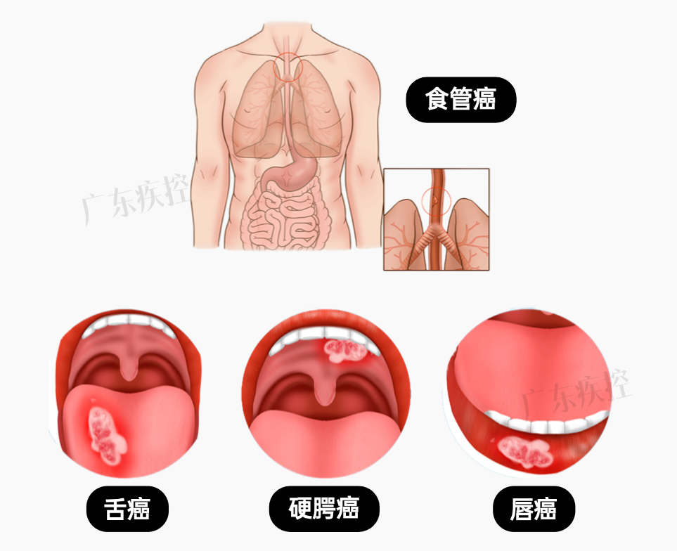 同色系列 (21).png