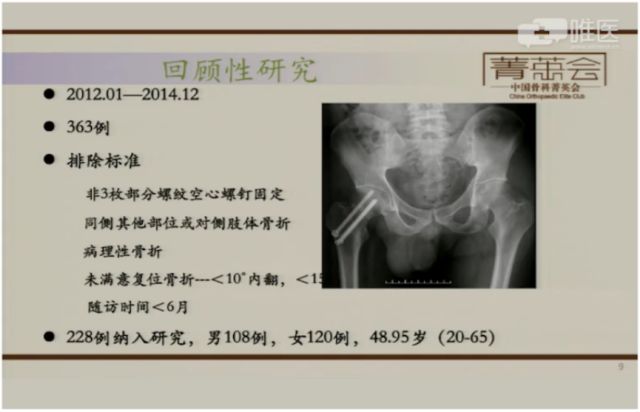 股骨颈骨折分型方法——vn分型