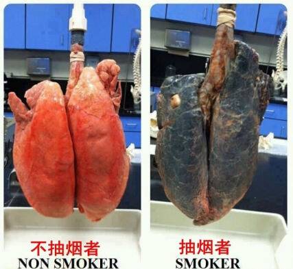 其实,对颜值的摧残只是抽烟最小的危害,你无法想象你的内脏器官被烟"
