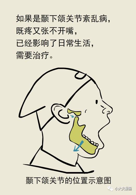 开口闭口关节疼,张不开嘴怎么办