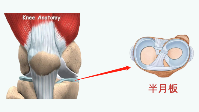 有些人年纪轻轻但半月板已经撑不住了