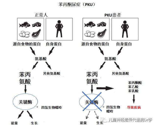 血尿代谢报告一点通【三】——苯丙酮尿症知多少