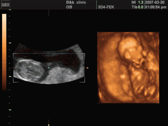 胎动已经告诉你性别，微弱or频繁暗藏生男生女玄机