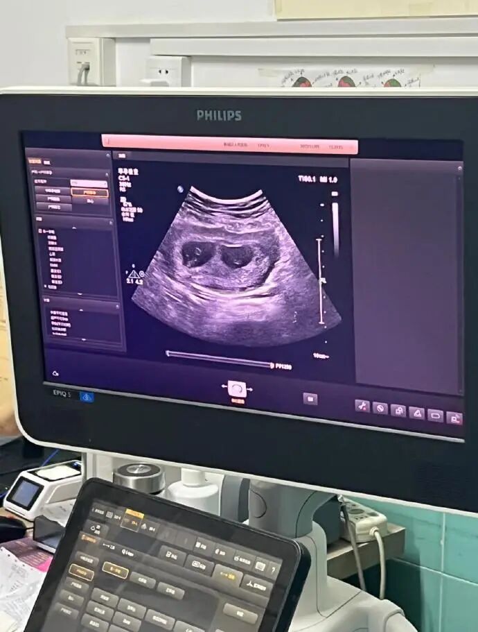 多次试管失败的原因都有哪些？试管失败的建议比成功的道理更可靠