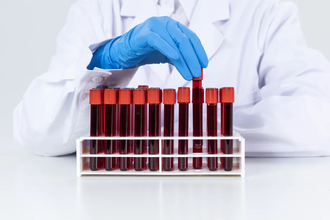 年轻≠好孕：23岁多囊女孩的试管助孕真实记录