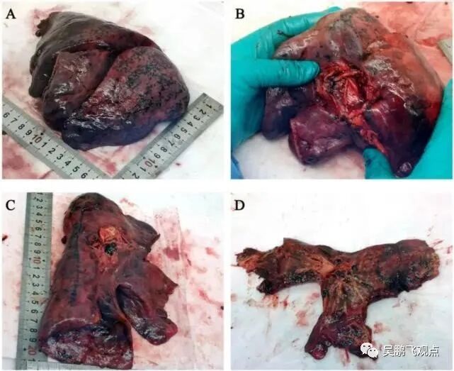 李跃华夫妇受韩国邀请前往抗疫