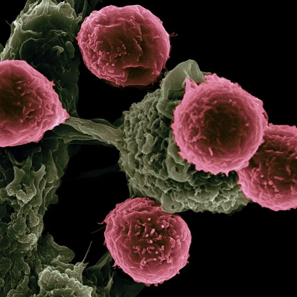 “解放天性”的NK细胞，癌细胞的“终结者”